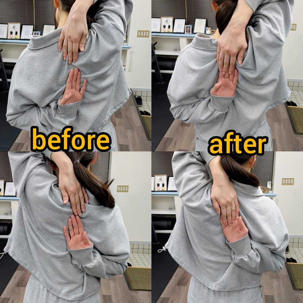 肩甲骨周り調整 before after その1