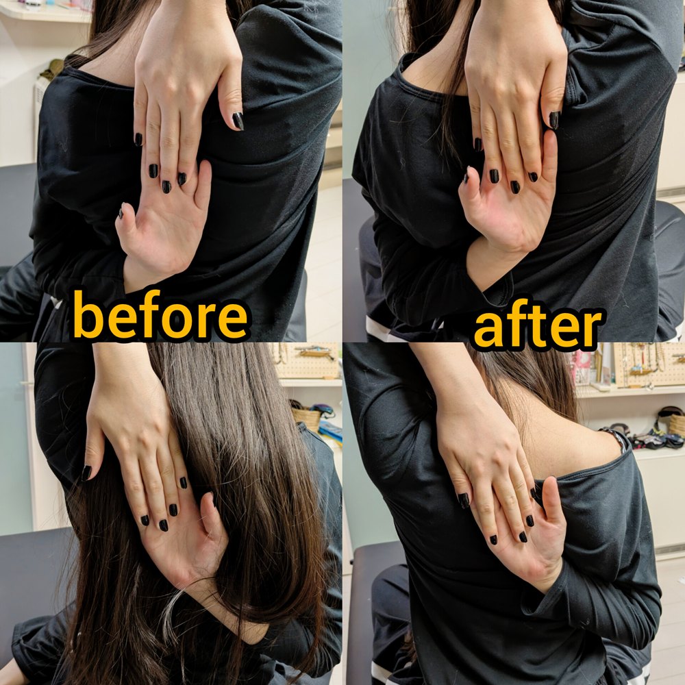 肩甲骨周り調整 before after その2